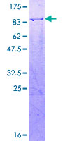 12.5% SDS-PAGE Stained with Coomassie Blue.